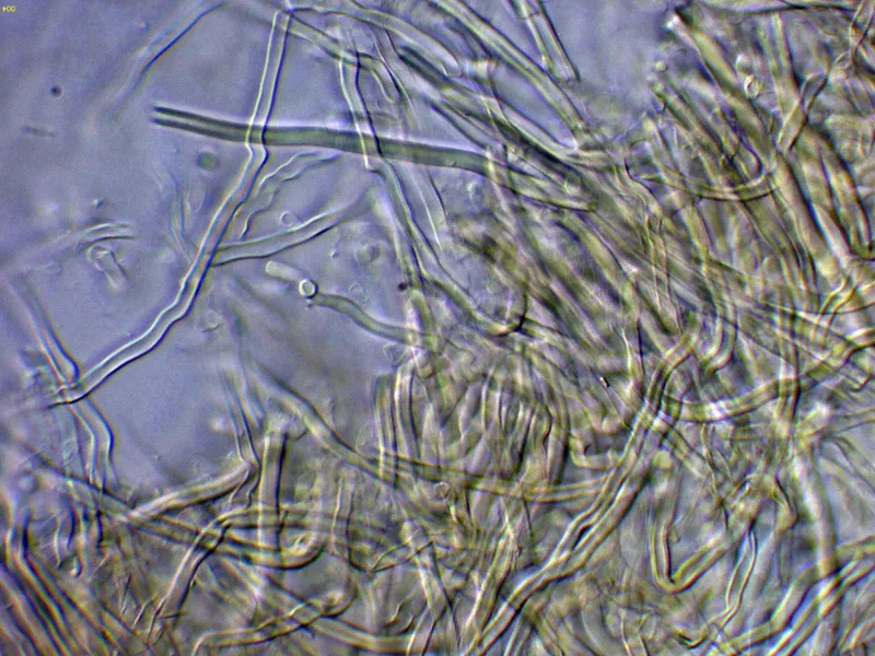 Antrodia albida 10 - Hifas Melzer-004